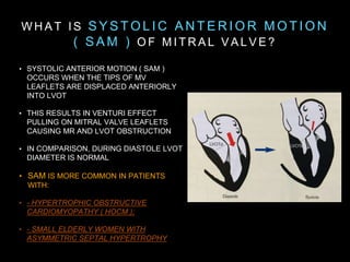 Mitral valve disease | PPTX