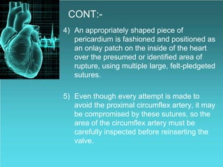 CONT:-
4) An appropriately shaped piece of
pericardium is fashioned and positioned as
an onlay patch on the inside of the heart
over the presumed or identified area of
rupture, using multiple large, felt-pledgeted
sutures.
5) Even though every attempt is made to
avoid the proximal circumflex artery, it may
be compromised by these sutures, so the
area of the circumflex artery must be
carefully inspected before reinserting the
valve.
 