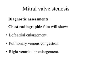 Mitral valve stenosis powerpoint | PPTX