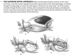 Mitral valve surgical treatment | PPTX