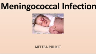 MITTAL PULKIT
Meningococcal Infection
 