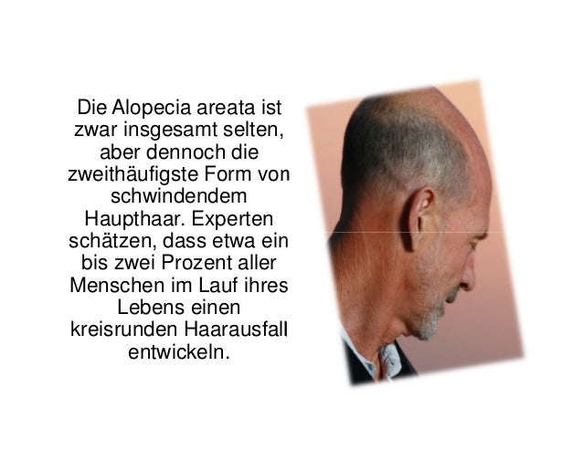 Die Kapseln für die Behandlung des Haares