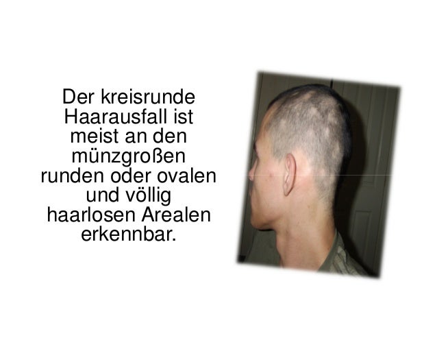 Die Aktivierung des Haarwuchses von den Volksmitteln