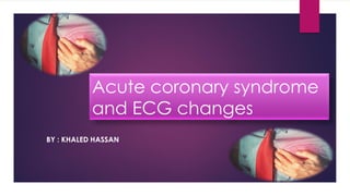Acute coronary syndrome
and ECG changes
BY : KHALED HASSAN
 