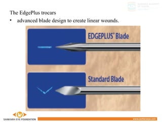 The EdgePlus trocars
• advanced blade design to create linear wounds.
 