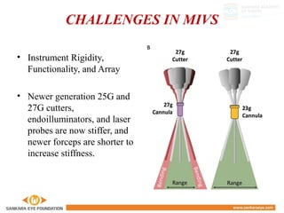 CHALLENGES IN MIVS
• Instrument Rigidity,
Functionality, and Array
• Newer generation 25G and
27G cutters,
endoilluminators, and laser
probes are now stiffer, and
newer forceps are shorter to
increase stiffness.
 