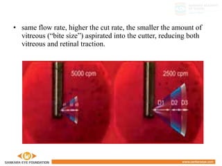 • same flow rate, higher the cut rate, the smaller the amount of
vitreous (“bite size”) aspirated into the cutter, reducing both
vitreous and retinal traction.
 