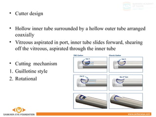 • Cutter design
• Hollow inner tube surrounded by a hollow outer tube arranged
coaxially
• Vitreous aspirated in port, inner tube slides forward, shearing
off the vitreous, aspirated through the inner tube
• Cutting mechanism
1. Guillotine style
2. Rotational
 