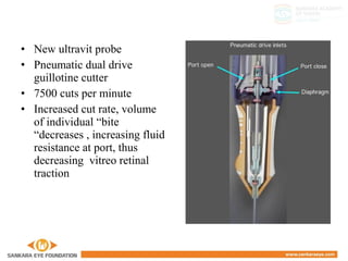 • New ultravit probe
• Pneumatic dual drive
guillotine cutter
• 7500 cuts per minute
• Increased cut rate, volume
of individual “bite
“decreases , increasing fluid
resistance at port, thus
decreasing vitreo retinal
traction
 