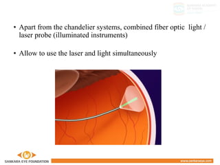 • Apart from the chandelier systems, combined fiber optic light /
laser probe (illuminated instruments)
• Allow to use the laser and light simultaneously
 