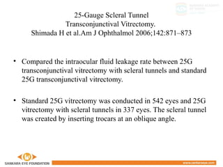 25-Gauge Scleral Tunnel
Transconjunctival Vitrectomy.
Shimada H et al.Am J Ophthalmol 2006;142:871–873
• Compared the intraocular fluid leakage rate between 25G
transconjunctival vitrectomy with scleral tunnels and standard
25G transconjunctival vitrectomy.
• Standard 25G vitrectomy was conducted in 542 eyes and 25G
vitrectomy with scleral tunnels in 337 eyes. The scleral tunnel
was created by inserting trocars at an oblique angle.
 