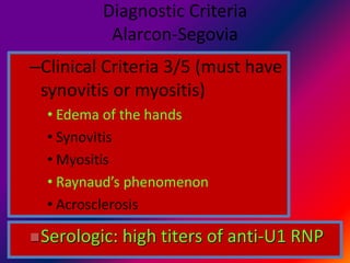 Diagnostic Criteria
Alarcon-Segovia
–Clinical Criteria 3/5 (must have
synovitis or myositis)
• Edema of the hands
• Synovitis
• Myositis
• Raynaud’s phenomenon
• Acrosclerosis
Serologic: high titers of anti-U1 RNP
 