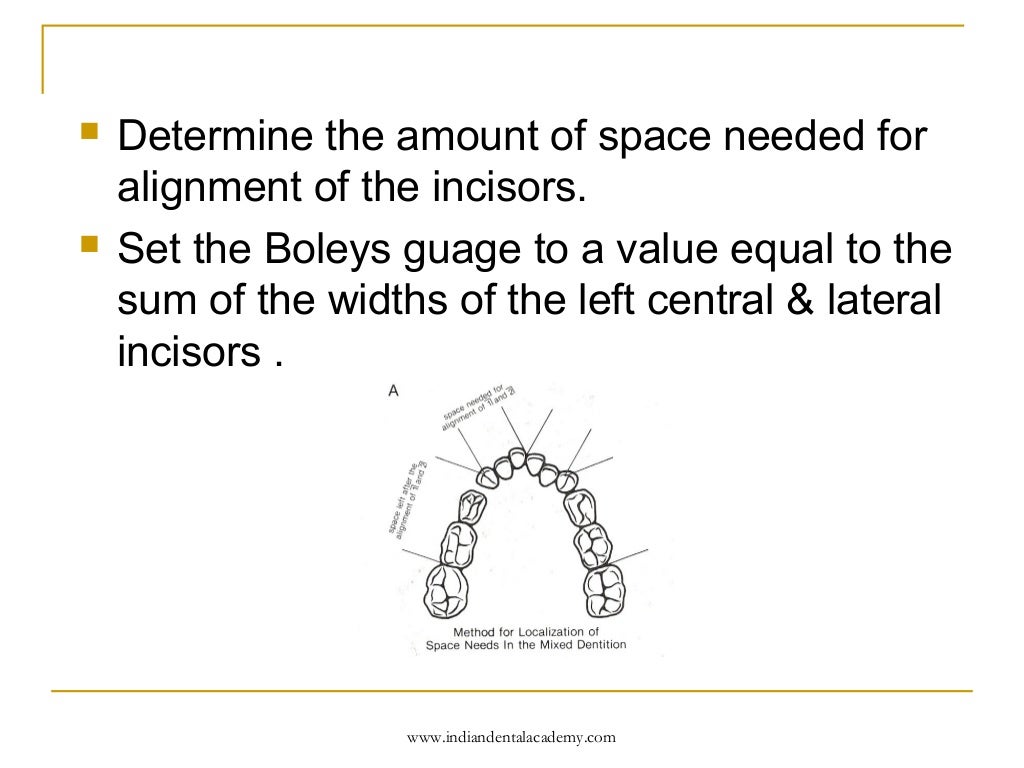 Mixed dentition analysis2 /certified fixed orthodontic courses by Ind…