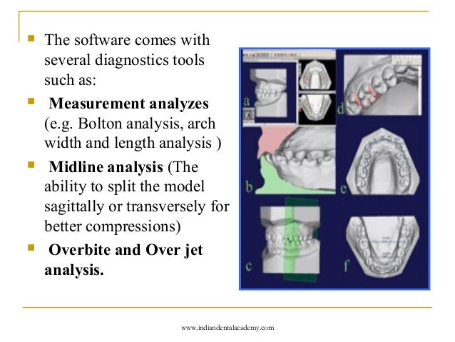Mixed dentition analysis2 /certified fixed orthodontic courses by Ind…
