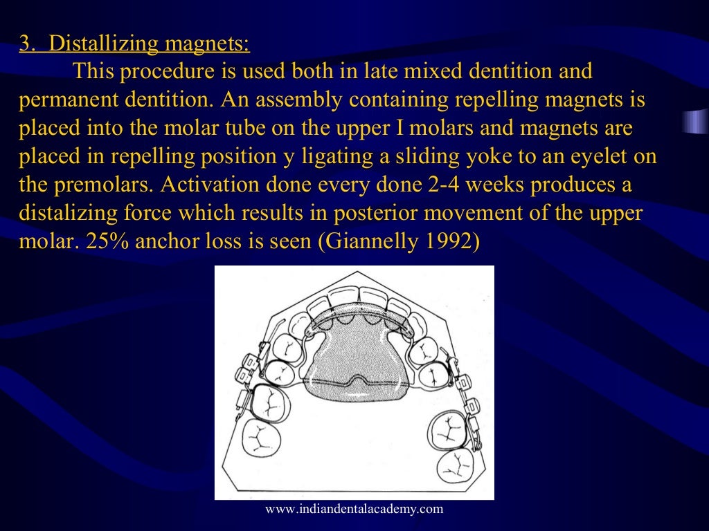 Mixed dentition orthodontic treatment /certified fixed orthodontic co…