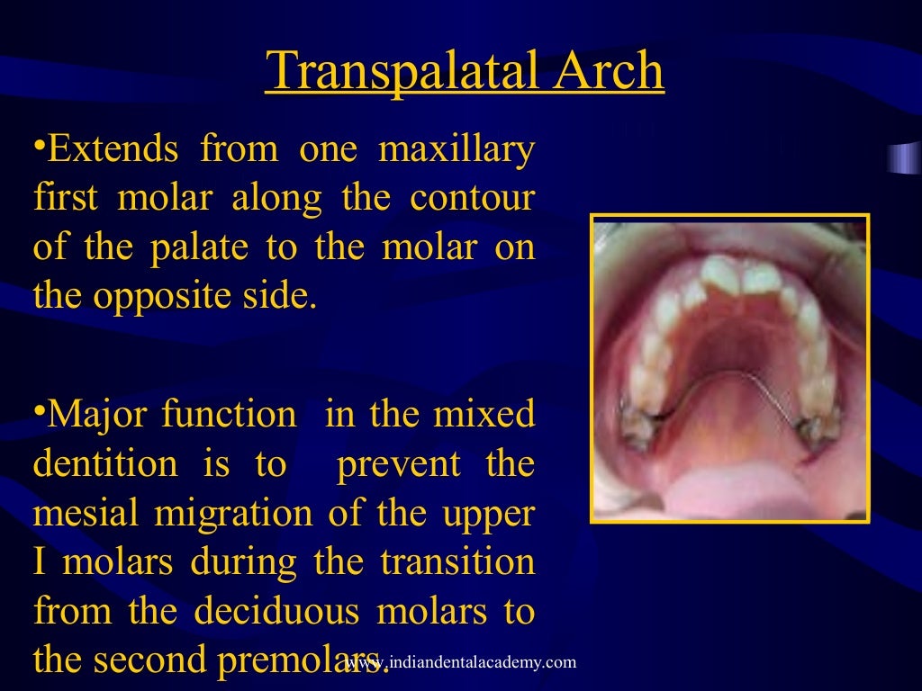 Mixed dentition ortho treatment /certified fixed orthodontic courses