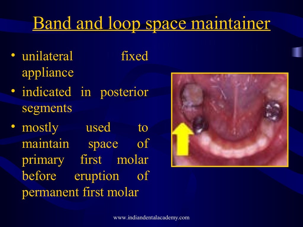 Mixed dentition ortho treatment /certified fixed orthodontic courses
