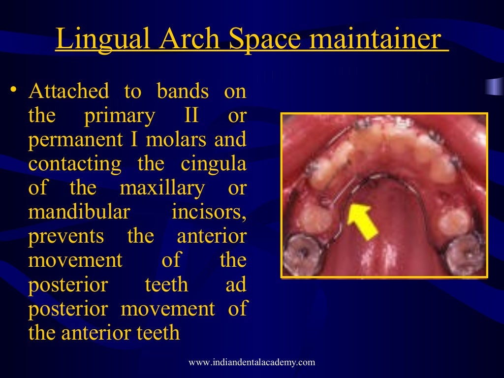 Mixed dentition ortho treatment /certified fixed orthodontic courses