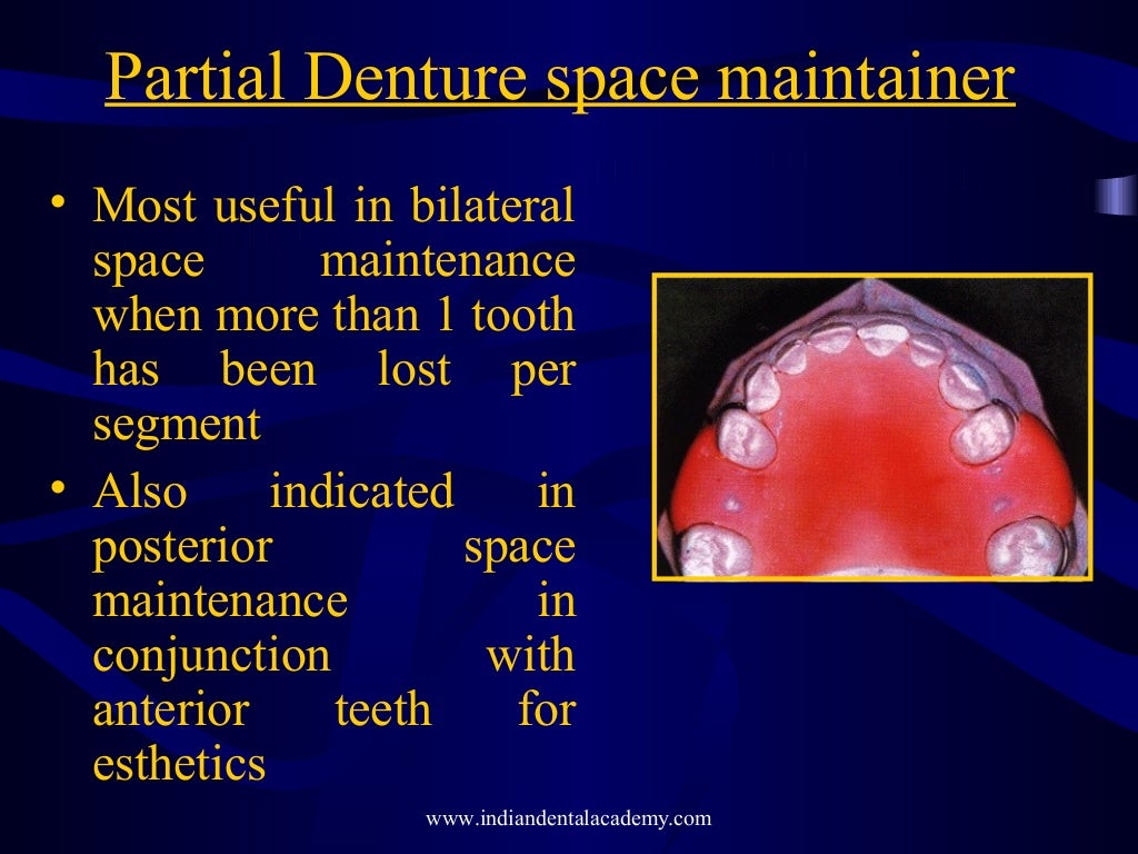 Mixed dentition ortho treatment /certified fixed orthodontic courses