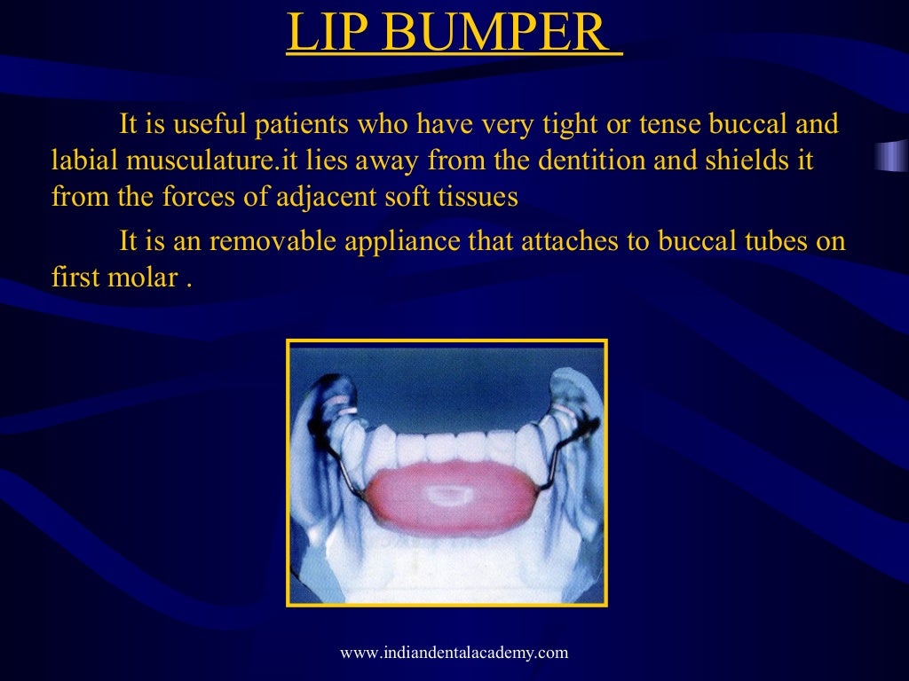 Mixed dentition ortho treatment /certified fixed orthodontic courses