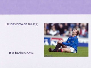 He has broken his leg.
It is broken now.
 