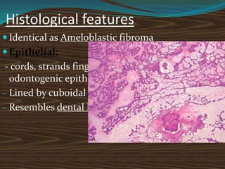 Histological features
 Identical as Ameloblastic fibroma
 Epithelial:
- cords, strands fingers and rosettes of
odontogenic epithelium
- Lined by cuboidal and columnar cells
- Resembles dental lamina
 