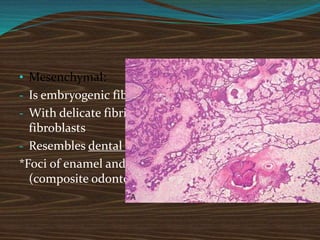 • Mesenchymal:
- Is embryogenic fibrous connective tissue
- With delicate fibrils, interspersed by primitive
fibroblasts
- Resembles dental papilla
*Foci of enamel and dentin matrix formation
(composite odontoma)
 