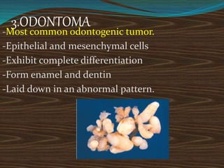 3.ODONTOMA
-Most common odontogenic tumor.
-Epithelial and mesenchymal cells
-Exhibit complete differentiation
-Form enamel and dentin
-Laid down in an abnormal pattern.
 