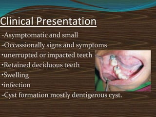 Clinical Presentation
-Asymptomatic and small
-Occassionally signs and symptoms
•unerrupted or impacted teeth
•Retained deciduous teeth
•Swelling
•infection
-Cyst formation mostly dentigerous cyst.
 