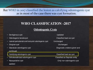 But WHO in 2017 classified the lesion as calcifying odontogenic cyst
as in most of the case there was cyst formation.
 