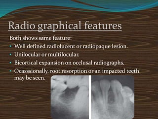 Radio graphical features
Both shows same feature:
• Well defined radiolucent or radiopaque lesion.
• Unilocular or multilocular.
• Bicortical expansion on occlusal radiographs.
• Ocasssionally, root resorption or an impacted teeth
may be seen.
 