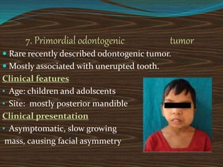 7. Primordial odontogenic tumor
 Rare recently described odontogenic tumor.
 Mostly associated with unerupted tooth.
Clinical features
• Age: children and adolscents
• Site: mostly posterior mandible
Clinical presentation
• Asymptomatic, slow growing
mass, causing facial asymmetry
 