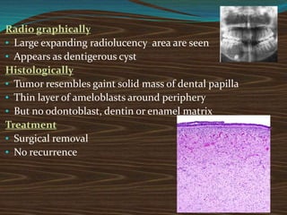 Radio graphically
• Large expanding radiolucency area are seen
• Appears as dentigerous cyst
Histologically
• Tumor resembles gaint solid mass of dental papilla
• Thin layer of ameloblasts around periphery
• But no odontoblast, dentin or enamel matrix
Treatment
• Surgical removal
• No recurrence
 