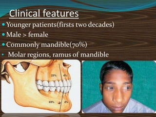 Clinical features
 Younger patients(firsts two decades)
 Male > female
 Commonly mandible(70%)
• Molar regions, ramus of mandible
 
