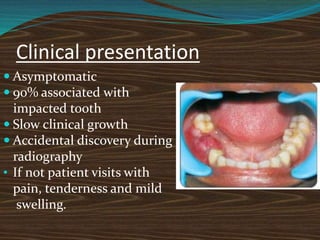 Clinical presentation
 Asymptomatic
 90% associated with
impacted tooth
 Slow clinical growth
 Accidental discovery during
radiography
• If not patient visits with
pain, tenderness and mild
swelling.
 