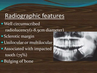 Radiographic features
 Well circumscribed
radiolucency(1-8.5cm diameter)
 Sclerotic margin
 Unilocular or multilocular
 Associated with impacted
tooth (75%)
 Bulging of bone
 