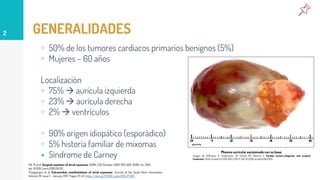 GENERALIDADES
▹ 50% de los tumores cardiacos primarios benignos (5%)
▹ Mujeres – 60 años
Localización
▹ 75%  aurícula izquierda
▹ 23%  aurícula derecha
▹ 2%  ventrículos
▹ 90% origen idiopático (esporádico)
▹ 5% historia familiar de mixomas
▸ Síndrome de Carney
2
Hill, M et al. Surgical resection of atrial myxomas. AORN J 92 (October 2010) 393-406. AORN, Inc, 2010.
doi: 10.1015/j.aorn.2010.06.012.
Thyagarajan et al. Extracardiac manifestations of atrial myxomas. Journal of the Saudi Heart Association.
Volume 29. Issue 1. January 2017. Pages 37-43. https://doi.org/10.1016/j.jsha.2016.07.003
Mixoma auricular excisionado con su base.
Imagen de Hoffmeier A, Sindermann JR, Scheld HH, Martens S: Cardiac tumors-diagnosis and surgical
treatment. Dtsch Arztebl Int 2014; 11(12): 205-11. DOI: 10.3238/arztebl.2014.0205.
 