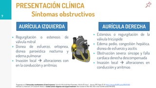 PRESENTACIÓN CLÍNICA
Síntomas obstructivos
▸ Regurgitación o estenosis de
válvula mitral
▸ Disnea de esfuerzo, ortopnea,
disnea paroxística nocturna y
edema pulmonar
▸ Invasión local  alteraciones con
en la conducción y arritmias
7
Thyagarajan et al. Extracardiac manifestations of atrial myxomas. Journal of the Saudi Heart Association. Volume 29. Issue 1. January 2017. Pages 37-43. https://doi.org/10.1016/j.jsha.2016.07.003
Hoffmeier A, Sindermann JR, Scheld HH, Martens S: Cardiac tumors-diagnosis and surgical treatment. Dtsch Arztebl Int 2014; 11(12): 205-11. DOI: 10.3238/arztebl.2014.0205.
AURÍCULA IZQUIERDA
▸ Estenosis o regurgitación de la
válvula tricúspide
▸ Edema pedio, congestión hepática,
disnea de esfuerzo y ascitis
▸ Obstrucción severa: síncope y falla
cardíaca derecha descompensada
▸ Invasión local  alteraciones en
conducción y arritmias
AURÍCULA DERECHA
 