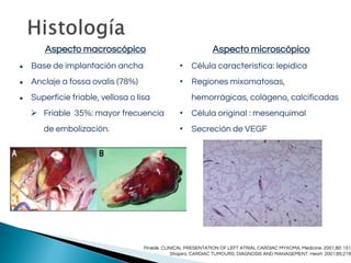 Aspecto macroscópico
● Base de implantación ancha
● Anclaje a fossa ovalis (78%)
● Superficie friable, vellosa o lisa
 Friable 35%: mayor frecuencia
de embolización.
Aspecto microscópico
• Célula característica: lepídica
• Regiones mixomatosas,
hemorrágicas, colágeno, calcificadas
• Célula original : mesenquimal
• Secreción de VEGF
Pinede. CLINICAL PRESENTATION OF LEFT ATRIAL CARDIAC MYXOMA. Medicine. 2001;80: 151
Shapiro. CARDIAC TUMOURS: DIAGNOSIS AND MANAGEMENT. Heart. 2001;85;218
 