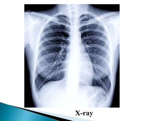 X-ray
 