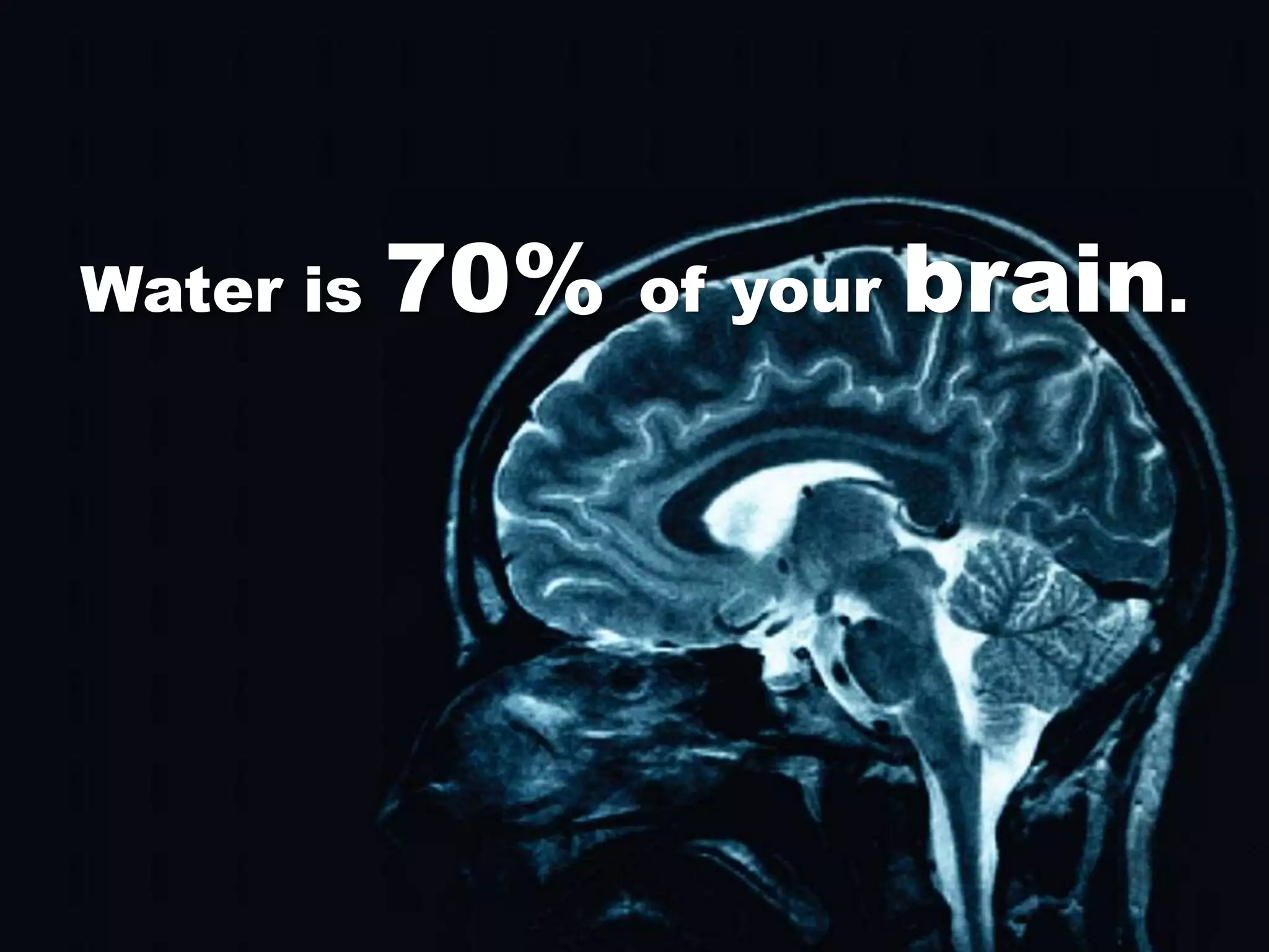 Water is   70%   of your   brain.
 
