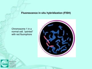 Fluorescence in situ hybridization (FISH) 
Chromosome 1 in a 
normal cell, “painted” 
with red fluorophore 
 