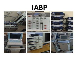 IABP
 