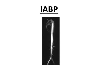 IABP
 