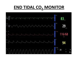 END TIDAL CO2 MONITOR
 