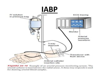 IABP
 
