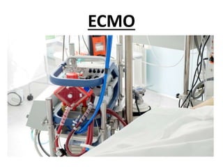 ECMO
 