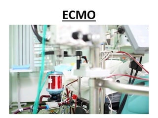 ECMO
 