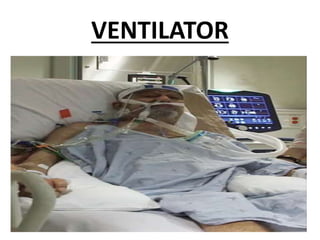 VENTILATOR
 