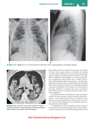 Basic radiology, 2nd ed.